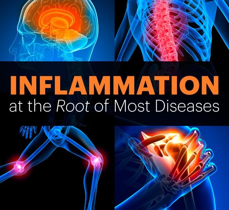 INFLAMMATION IS OFTEN CAUSED BY ACUTE MALADAPTIVE REACTIONS TO FOODS, CHEMICALS, AND INHALANTS. ACIDITY IS THE COMMON DENOMINATOR OF THESE MALADAPTIVE REACTIONS, AND THEY ARE USUALLY ACCOMPANIED BY VARIOUS DISCOMFORTS AND PAINS. COMBINE WITH OTHER THERAPIES, NEGATIVE MAGNETIC THERAPY REVERSES THE CONDITIONS PRODUCING A NORMAL, AKALINE STATE WITH AN ABUNDANCE OF MOLECULAR OXYGEN. THUS REVERSING INFLAMMATION AND RELEIVES THE PAIN ASSOCIATED WITH IT.
